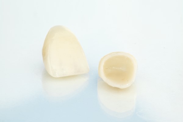 CEREC® Crowns Vs  Traditional Dental Crowns